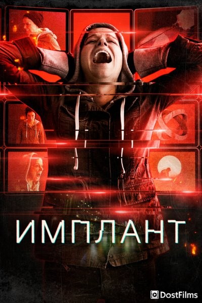 Имплантированная